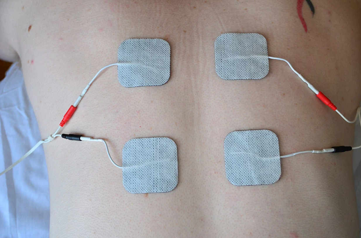 TENS Therapy